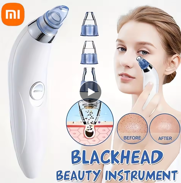 4-in-1 Multifunctional Beauty Pore Vacuum – Unlock Radiant, Flawless Skin